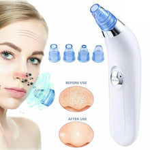 Load image into Gallery viewer, Derma Suction Blackhead Acne Oil Remover Vacuum Suction Face Pore Cleaner